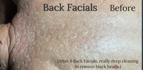 15533-back-facials-b1-768x377.jpg