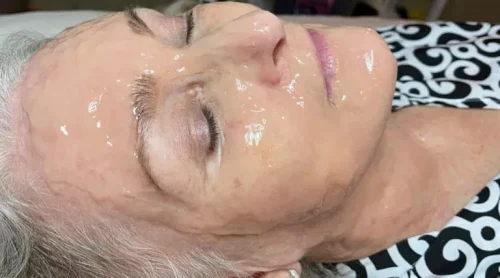 15533-facial-c5-b1-768x427.jpg