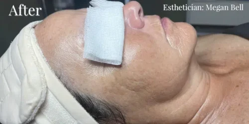 15533-signature-facial-a1-768x384.jpg
