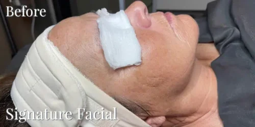 15533-signature-facial-b1-768x384.jpg