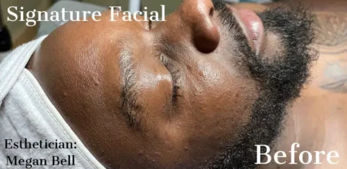 15533-signature-facial-b4-768x373.jpg